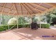 31 Kambah Pl, West Pennant Hills NSW 2125