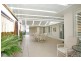 11 Birch Drive, Hamlyn Terrace NSW 2259